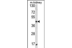 ALKBH3 Antikörper  (C-Term)