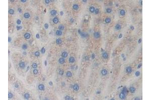 Detection of RNASE3 in Rat Liver Tissue using Polyclonal Antibody to Ribonuclease A3 (RNASE3) (RNASE3 Antikörper  (AA 33-155))