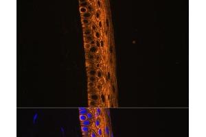Immunofluorescence analysis of Rat eye using MYH13 Polyclonal Antibody at dilution of 1:100 (40x lens). (MYH13 Antikörper)