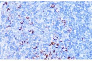 Immunohistochemistry of paraffin-embedded Mouse spleen using SHMT2 Polyclonal Antibody at dilution of 1:100 (40x lens).
