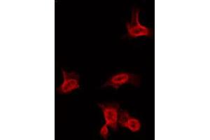 ABIN6266636 staining HuvEc by IF/ICC. (Sodium Channel-Pan Antikörper)