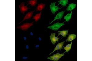 ABIN7095462 and ABIN7099519 staining  cells by IF/ICC. (FAM83B Antikörper)