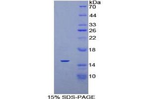 SDS-PAGE analysis of Rat PDGFAA Protein. (PDGF-AA Homodimer Protein)