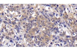 Immunohistochemistry (IHC) image for anti-BCL2-Like 1 (BCL2L1) (AA 2-212) antibody (ABIN7437176)