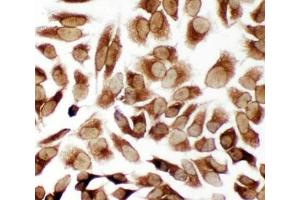 Immunocytochemistry (ICC) image for anti-Toll-Like Receptor Adaptor Molecule 2 (TICAM2) (C-Term) antibody (ABIN3029187)