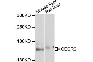 Western blot analysis of extracts of mouse liver and rat liver cells, using CECR2 antibody.