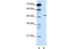 WB Suggested Anti-GABRB2 Antibody Titration:  0. (GABRB2 Antikörper  (N-Term))