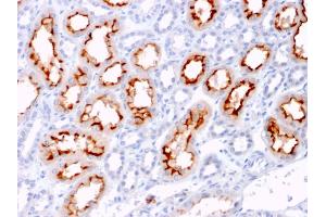 Formalin-fixed, paraffin-embedded human Renal Cell Carcinoma stained with CD137L-Monospecific Mouse Monoclonal Antibody (CD137L/1547). (TNFSF9 Antikörper)