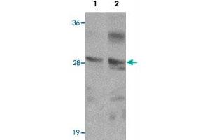 Western blot analysis of TMEM192 in SK-N-SH cell lysate with TMEM192 polyclonal antibody  at (1) 0. (TMEM192 Antikörper  (C-Term))