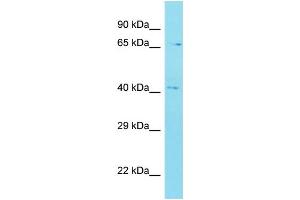Host: Rabbit Target Name: C12orf56 Sample Type: MDA-MB-435S Whole Cell lysates Antibody Dilution: 1. (C12orf56 Antikörper  (N-Term))