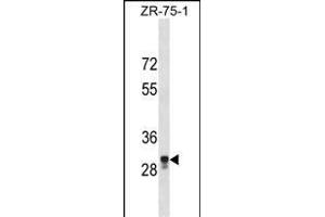 PED2 Antibody (C-term) (ABIN1536882 and ABIN2850012) western blot analysis in ZR-75-1 cell line lysates (35 μg/lane). (MPPED2 Antikörper  (C-Term))