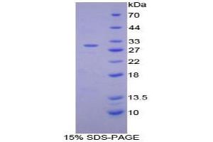 SDS-PAGE analysis of Mouse Integrin alpha D Protein. (ITGAD Protein)