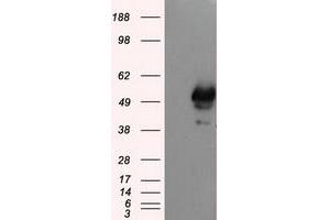Image no. 2 for anti-SHC (Src Homology 2 Domain Containing) Transforming Protein 1 (SHC1) antibody (ABIN1499995) (SHC1 Antikörper)