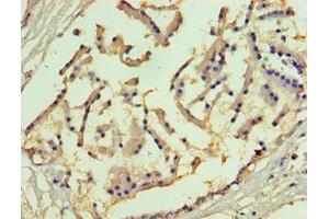 Immunohistochemistry of paraffin-embedded human prostate tissue using ABIN7158496 at dilution of 1:100
