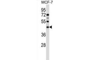 Western Blotting (WB) image for anti-Sphingomyelin Synthase 1 (SGMS1) antibody (ABIN2997403) (Sphingomyelin Synthase 1 Antikörper)
