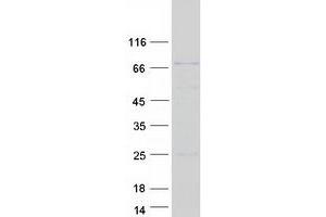 Western Blotting (WB) image for DCP1 Decapping Enzyme Homolog A (S. Cerevisiae) (DCP1A) protein (Myc-DYKDDDDK Tag) (ABIN2719246)