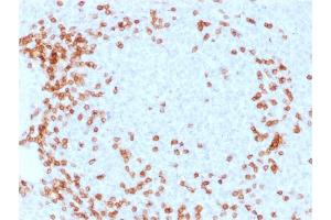 Immunohistochemistry (IHC) image for anti-CD3 epsilon (CD3E) (AA 23-119) antibody (ABIN6941022)