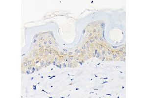 Immunohistochemistry of paraffin-embedded mouse skin using Involucrin Rabbit mAb (ABIN6128025, ABIN6141815, ABIN6141818 and ABIN7101419) at dilution of 1:100 (40x lens). (Involucrin Antikörper)