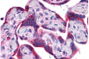 Immunohistochemistry (Formalin-fixed Paraffin-embedded Sections) (IHC (fp)) image for anti-ATG5 Autophagy Related 5 (ATG5) (C-Term) antibody (ABIN6745751)
