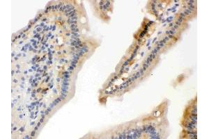 IHC analysis of Hsp70 using anti-Hsp70 antibody (ABIN3043849).