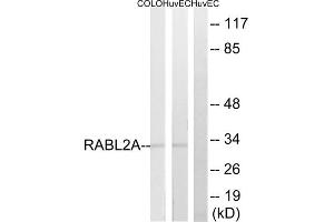 Western blot analysis of extracts from HuvEc, 293 and COLO205 cells, using RABL2A antibody. (RABL2A Antikörper  (C-Term))