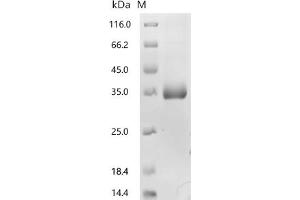 Insulin-Like Growth Factor Binding Protein 7 (IGFBP7) (AA 27-282), (full length) protein (His tag)