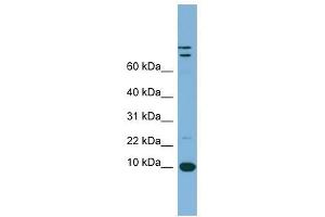 TFF1 antibody used at 1 ug/ml to detect target protein. (TFF1 Antikörper  (Middle Region))