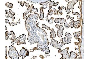 IHC analysis of PDIA5 using anti-PDIA5 antibody (ABIN7601801). (PDIA5 Antikörper  (AA 46-481))