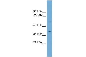 WB Suggested Anti-MGLL Antibody Titration: 0.