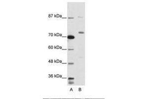Image no. 2 for anti-Exosome Component 10 (EXOSC10) (C-Term) antibody (ABIN203030)