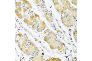 Immunohistochemistry of paraffin-embedded human stomach using C4BPB antibody at dilution of 1:100 (40x lens). (C4BPB Antikörper)