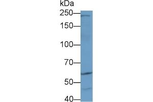 Detection of AKAP11 in Human Lung lysate using Polyclonal Antibody to A Kinase Anchor Protein 11 (AKAP11) (AKAP11 Antikörper  (AA 1650-1901))