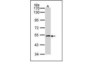Sample (30 µg of whole cell lysate). (XIAP Antikörper  (AA 75-226))
