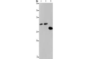 Western Blotting (WB) image for anti-serpin Peptidase Inhibitor, Clade B (Ovalbumin), Member 3 (SERPINB3) antibody (ABIN2423789) (SERPINB3 Antikörper)