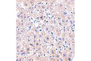 Immunohistochemistry of DRAM in human liver tissue with DRAM polyclonal antibody  at 2. (DRAM Antikörper  (C-Term))