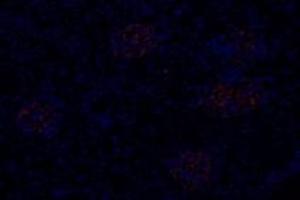 Immunofluorescent analysis of paraformaldehyde-fixed rat kidney using,Slc6a6 (ABIN7075842) at dilution of 1: 600 (TAUT Antikörper)