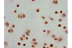 Immunocytochemistry analysis of Hela cells using ABIN7139173 at dilution of 1:100 (HIST1H3A Antikörper  (acLys23))