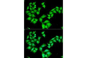 Immunofluorescence analysis of HeLa cell using AAAS antibody. (Adracalin Antikörper)