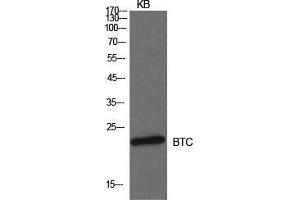 Western Blot (WB) analysis of KB cells using Probetacellulin Polyclonal Antibody. (Betacellulin Antikörper  (Internal Region))