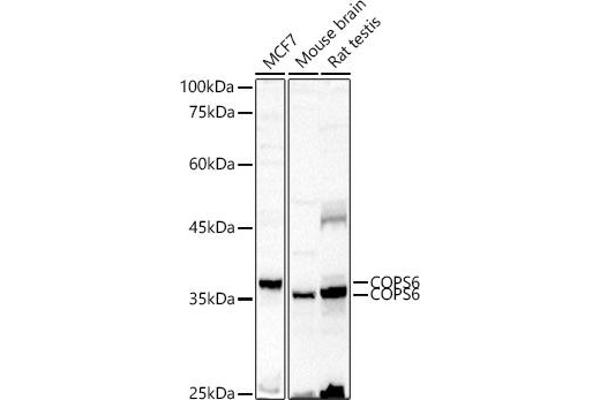 COPS6 Antikörper  (AA 58-327)