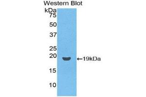 Western Blotting (WB) image for anti-CD59 (CD59) (AA 26-102) antibody (Biotin) (ABIN1174497) (CD59 Antikörper  (AA 26-102) (Biotin))