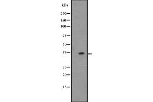 Western blot analysis of OR2T6 expression in ZR-75-1 cell line lysate ,The lane on the left is treated with the antigen-specific peptide. (OR2T6 Antikörper  (C-Term))