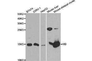 Western Blotting (WB) image for anti-MB antibody (ABIN1876659) (MB Antikörper)