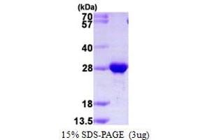 SDS-PAGE (SDS) image for RAB2B, Member RAS Oncogene Family (RAB2B) (AA 1-216) protein (His tag) (ABIN667645)