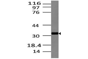 Image no. 1 for anti-C-Type Lectin Domain Family 6, Member A (CLEC6A) (AA 70-230) antibody (ABIN5027146) (C-Type Lectin Domain Family 6, Member A (CLEC6A) (AA 70-230) Antikörper)