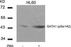 Image no. 3 for anti-GATA Binding Protein 1 (Globin Transcription Factor 1) (GATA1) (pSer142) antibody (ABIN196684) (GATA1 Antikörper  (pSer142))