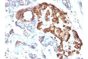 Formalin-fixed, paraffin-embedded rat pancreas stained with TNF alpha antibody. (TNF alpha Antikörper)