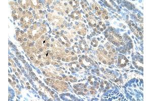 RAD23A antibody was used for immunohistochemistry at a concentration of 4-8 ug/ml to stain Epithelial cells of renal tubule (arrows) in Human Kidney. (RAD23A Antikörper)