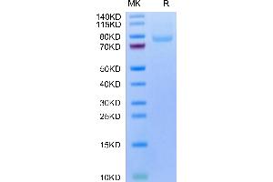 Human LRRC15 on Tris-Bis PAGE under reduced condition. (LRRC15 Protein (His-Avi Tag))