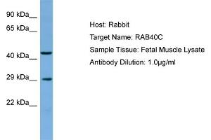 Host: Rabbit Target Name: RAB40C Sample Type: Fetal Muscle lysates Antibody Dilution: 1. (RAB40C Antikörper  (C-Term))